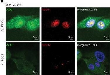 AGO1/EIF2C1 Antibody