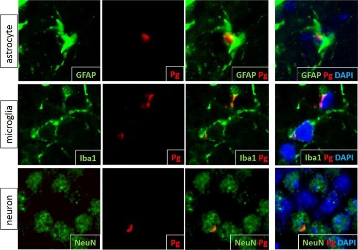 AIF-1/Iba1 Antibody