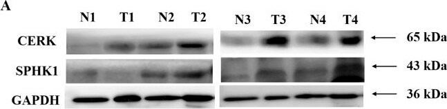 Ceramide Kinase Antibody - BSA Free