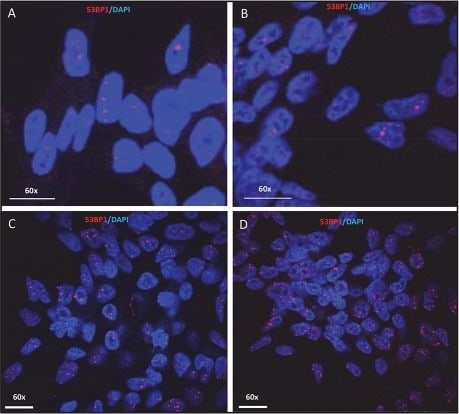 53BP1 Antibody - BSA Free