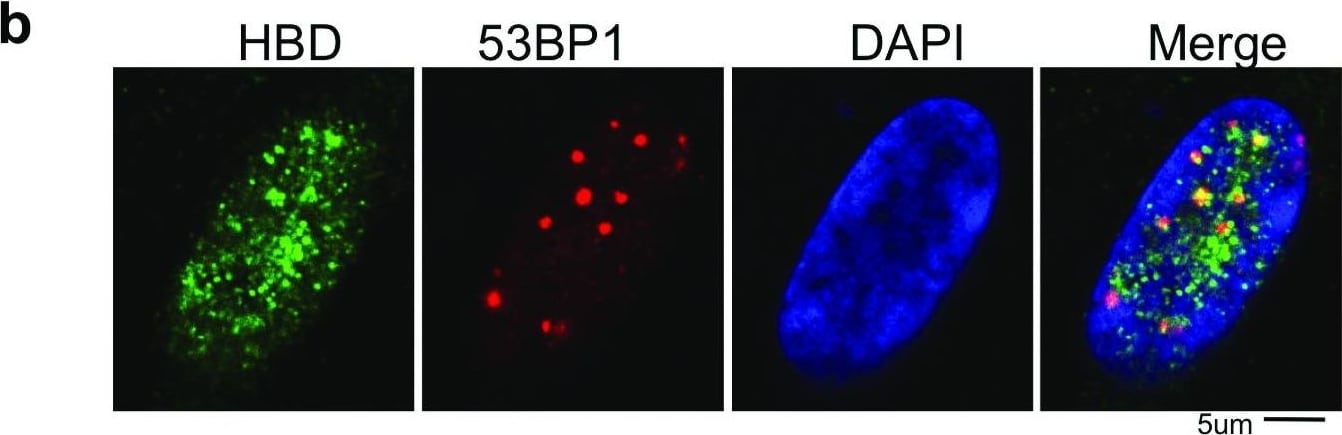 53BP1 Antibody - BSA Free