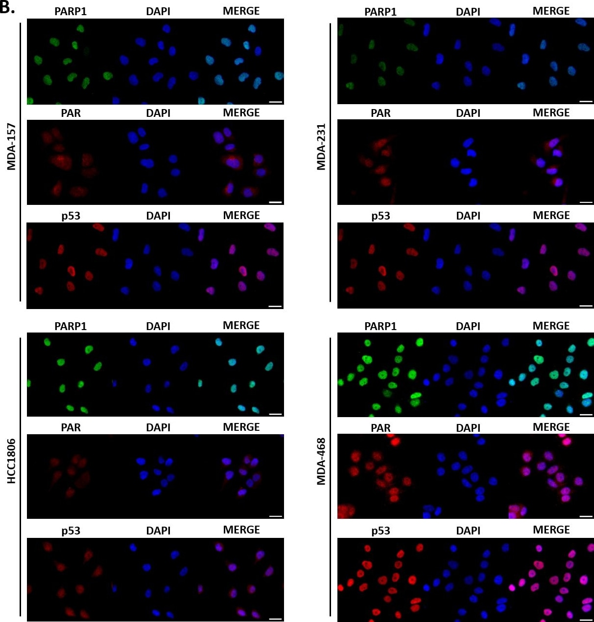 53BP1 Antibody - BSA Free
