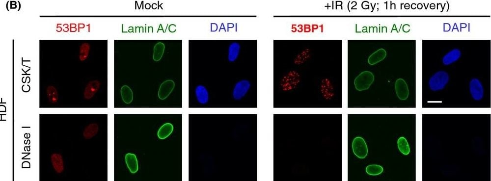 53BP1 Antibody - BSA Free
