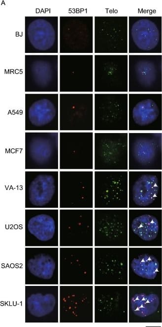 53BP1 Antibody - BSA Free