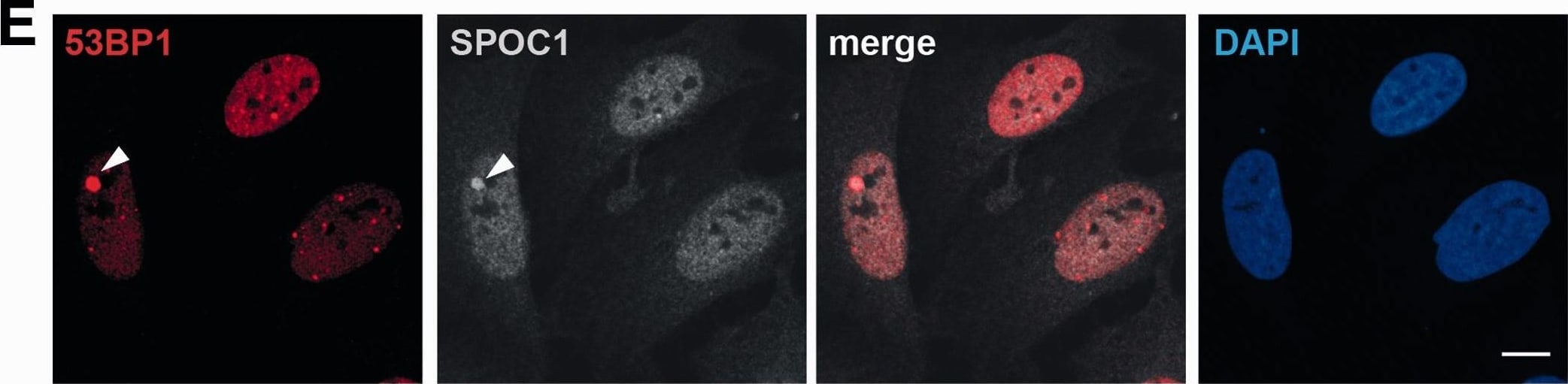 53BP1 Antibody - BSA Free