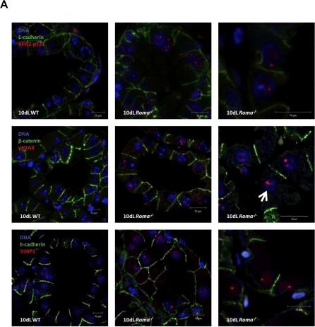 53BP1 Antibody - BSA Free