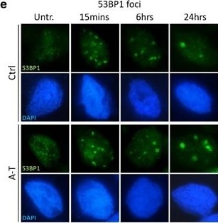 53BP1 Antibody - BSA Free