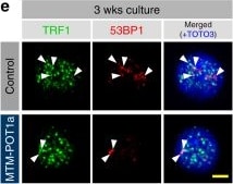 53BP1 Antibody - BSA Free