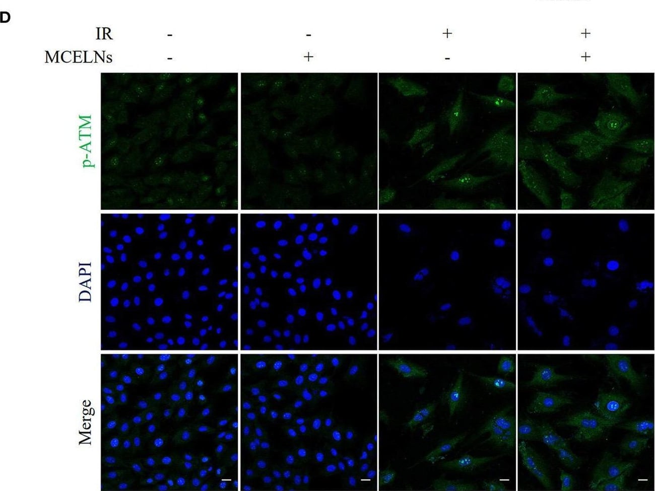 ATM [p Ser1981] Antibody (10H11.E12) - BSA Free