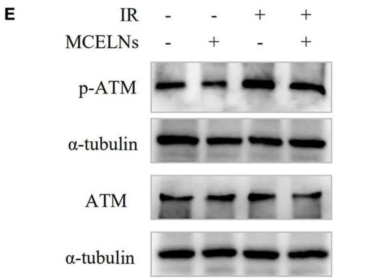 ATM Antibody (2C1)