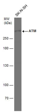 ATM Antibody (2C1)