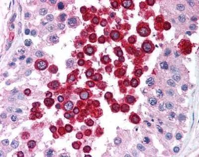 ATM Antibody (2C1) - Azide and BSA Free