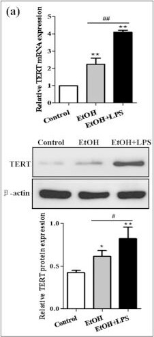 TERT Antibody (2C4)