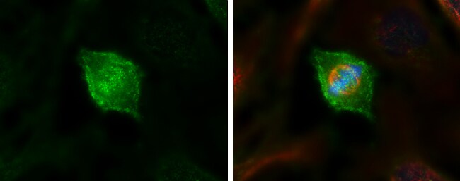 NDC80 Antibody (9G3.23)