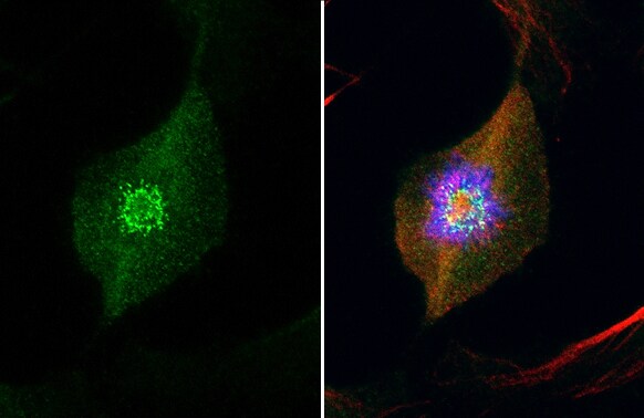 NDC80 Antibody (9G3.23)