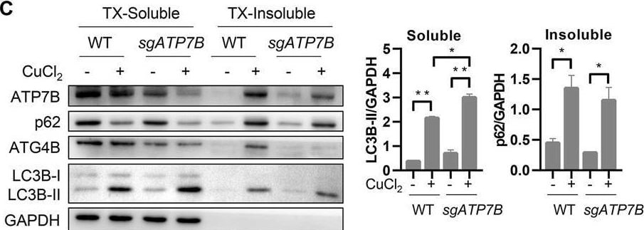 ATP7b Antibody - BSA Free