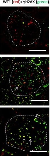 Histone H2AX [p Ser139] Antibody