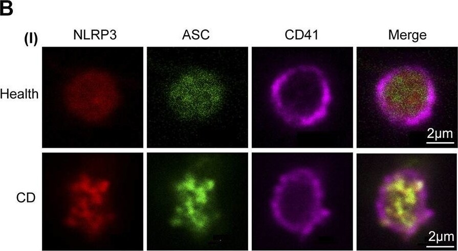 NLRP3/NALP3 Antibody