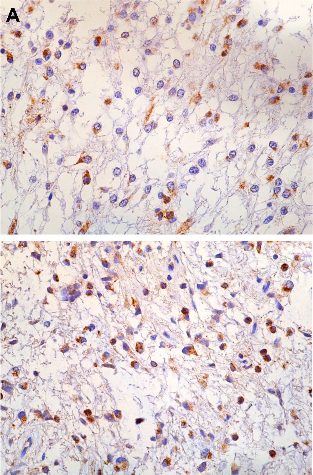 PBR Antibody