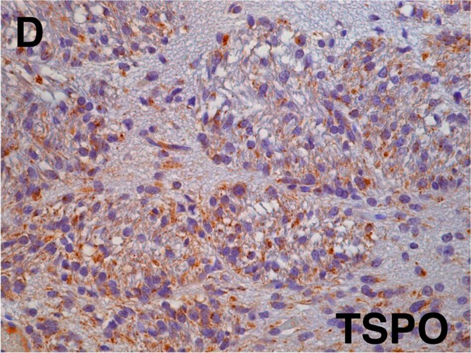 PBR Antibody
