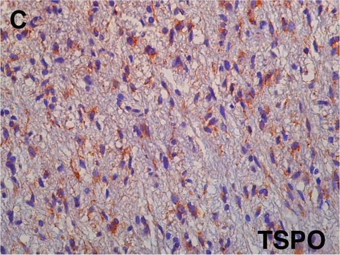 PBR Antibody