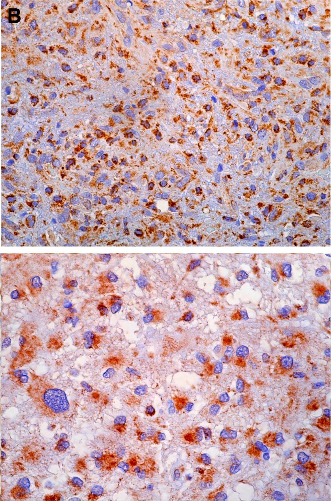 PBR Antibody