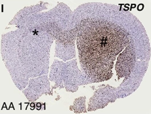 PBR Antibody