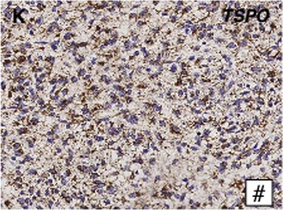 PBR Antibody