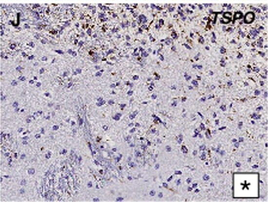 PBR Antibody