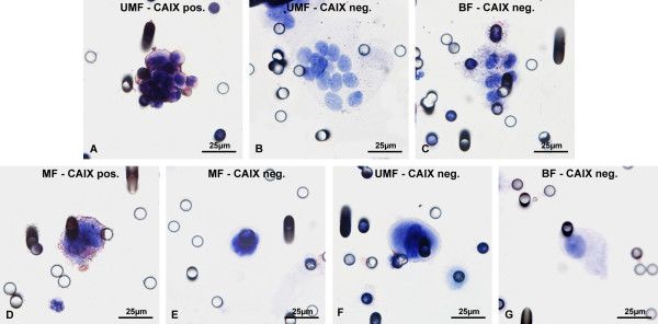 Carbonic Anhydrase IX/CA9 Antibody - BSA Free