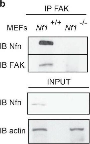 Neurofibromin 1 Antibody - BSA Free