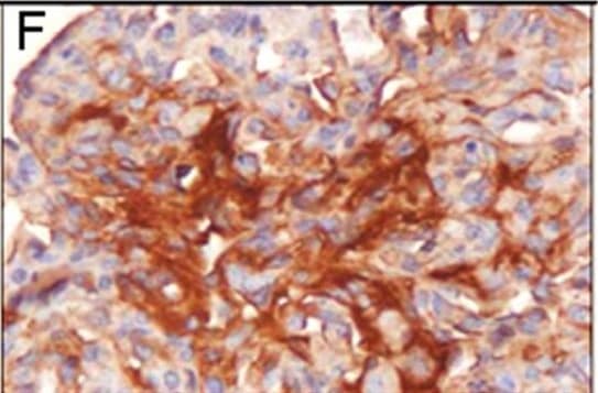 HIF-1 alpha Antibody