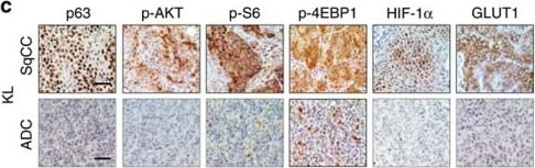HIF-1 alpha Antibody