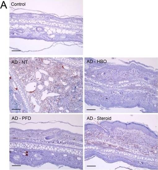 HIF-1 alpha Antibody