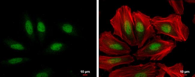XPC Antibody (3.26) - Azide and BSA Free