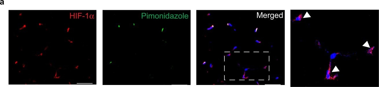 HIF-1 alpha Antibody - BSA Free