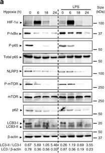 HIF-1 alpha Antibody - BSA Free