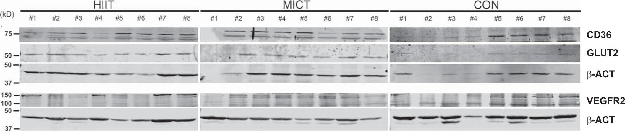 VEGFR2/KDR/Flk-1 Antibody