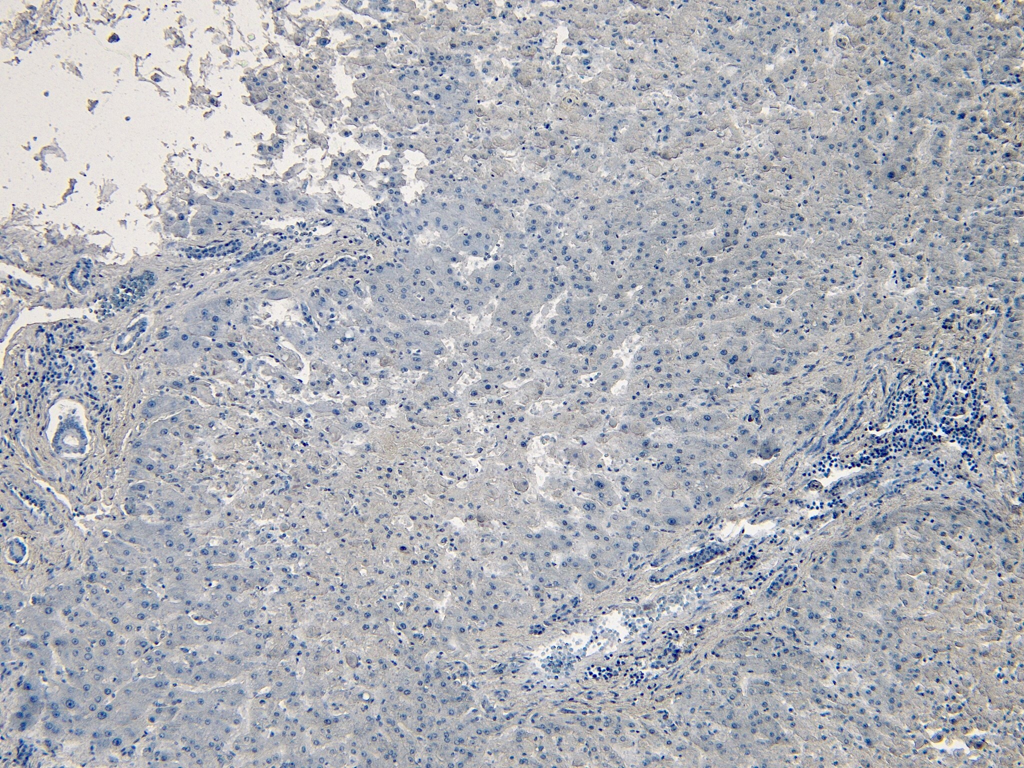CPT1A Antibody