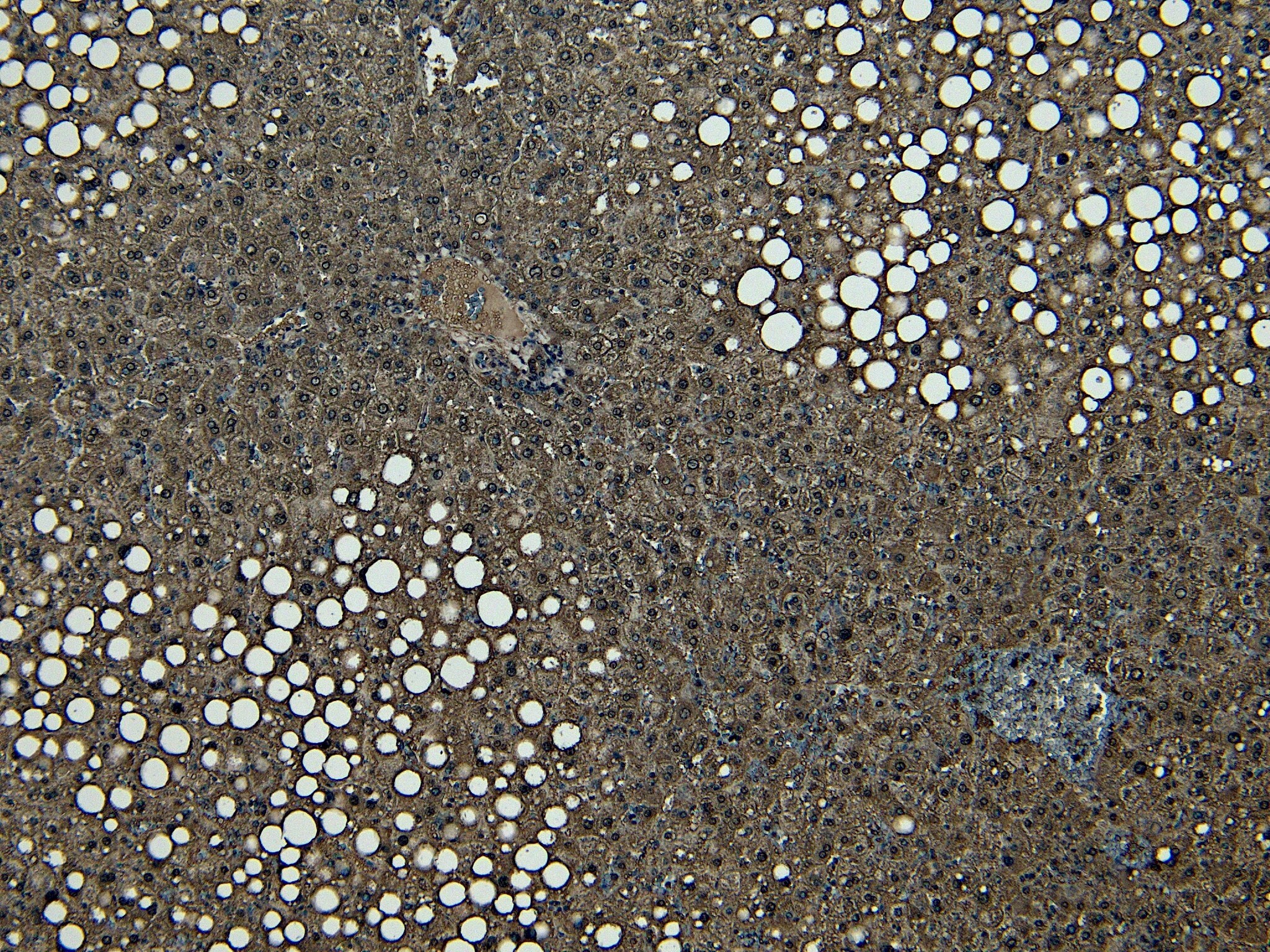 CPT1A Antibody