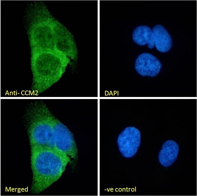 CCM2 Antibody