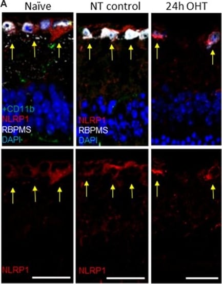 NLRP1/NALP1 Antibody