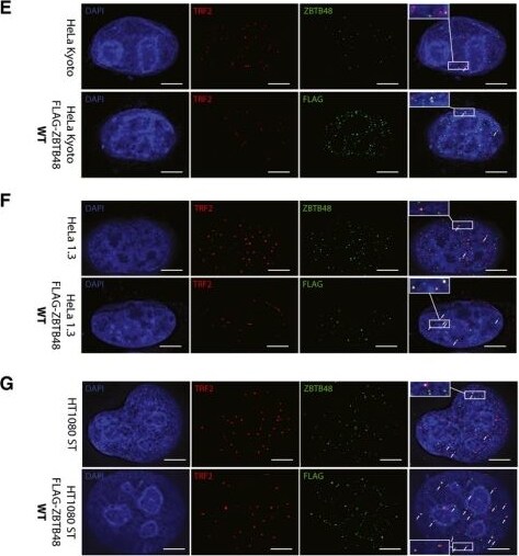 TRF-2 Antibody (4A794.15) - BSA Free