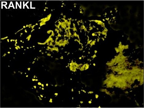 TRANCE/TNFSF11/RANK L Antibody (12A668) - BSA Free