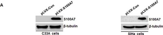 S100A7/Psoriasin Antibody (47C1068) - BSA Free