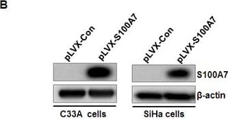 S100A7/Psoriasin Antibody (47C1068) - BSA Free