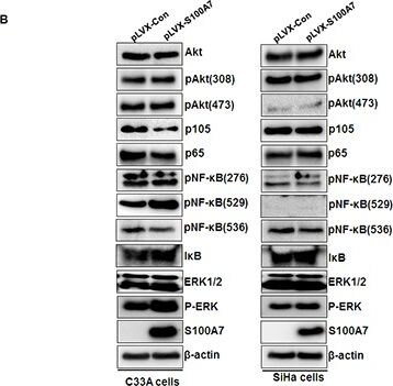 S100A7/Psoriasin Antibody (47C1068) - BSA Free