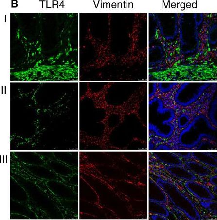 TLR4 Antibody (76B357.1) - BSA Free