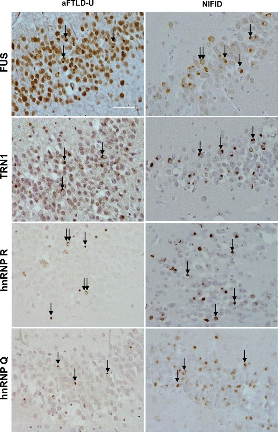 FUS Antibody