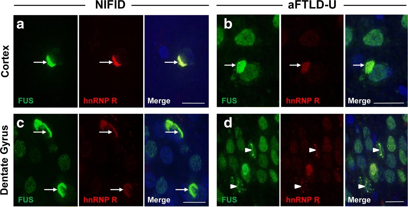FUS Antibody